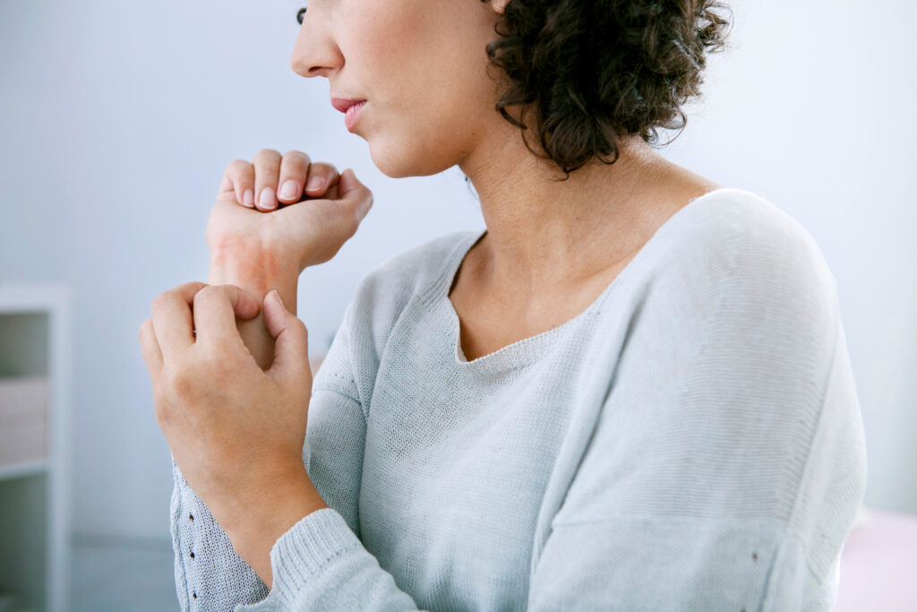 A woman with psoriasis scratches a red patch of inflamed skin on her hand.