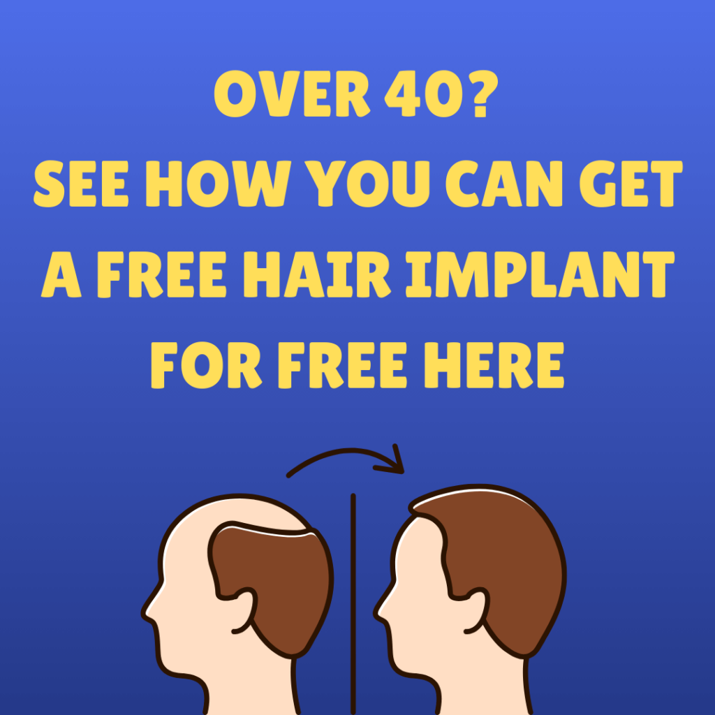 Getting hair implants